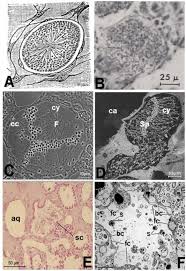 Attēlu rezultāti vaicājumam “Enteridium corticatum”