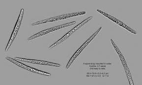 Attēlu rezultāti vaicājumam “Peltigera leucophlebia”