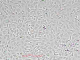 Attēlu rezultāti vaicājumam “Enteridium variabile plasmodium”