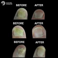 Image result for lunula nail