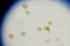 Attēlu rezultāti vaicājumam “Lophozia ventricosa”
