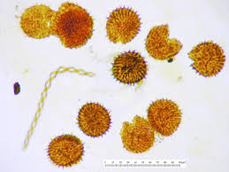 Attēlu rezultāti vaicājumam “Fossombronia wondraczekii”