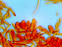 Attēlu rezultāti vaicājumam “Cinereomyces lindbladii”