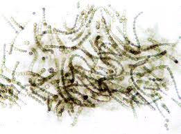 Attēlu rezultāti vaicājumam “Cyanophyta”