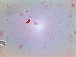 Attēlu rezultāti vaicājumam “Elmerina caryae”