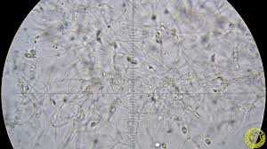 Attēlu rezultāti vaicājumam “Ombrophila violacea”