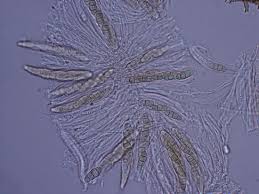 Attēlu rezultāti vaicājumam “Dianema nivale spores”