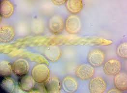 Attēlu rezultāti vaicājumam “Lycogala ustulatum macro”