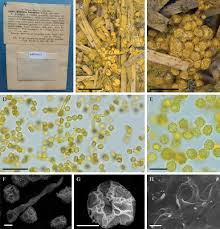 Attēlu rezultāti vaicājumam “Perichaena corticalis spores”