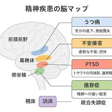 Image result for 衝動制御障害BPD