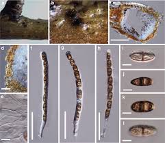 Attēlu rezultāti vaicājumam “Didymium spongiosum var. dictyospora spores”