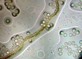 Attēlu rezultāti vaicājumam “Heterotrichia obvelata (syn. Arcyria obvelata) spores”