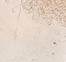 Attēlu rezultāti vaicājumam “Reticularia jurana spores”