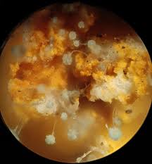 Attēlu rezultāti vaicājumam “Craterium minutum young”