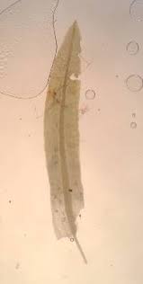 Attēlu rezultāti vaicājumam “Timmia megapolitana”