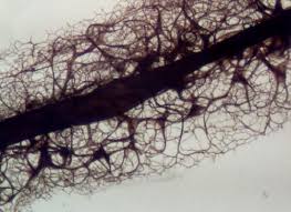 Attēlu rezultāti vaicājumam “Stemonitis fusca spores”