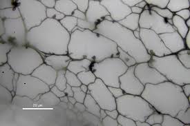 Attēlu rezultāti vaicājumam “Stemonitis fusca spores”