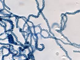 Attēlu rezultāti vaicājumam “Arcyria cinerea”