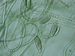 Attēlu rezultāti vaicājumam “Nostoc commune macro”