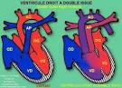 <b>Double Outlet Right Ventricle</b>