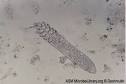 MicrobeLibrary - Demodex folliculorum (Follicle mite), Adult