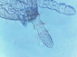 Attēlu rezultāti vaicājumam “Hypogastrura sp.”