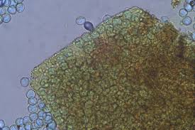 Attēlu rezultāti vaicājumam “Licea castanea sessile”