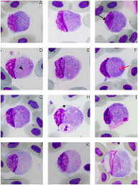 Attēlu rezultāti vaicājumam “Diderma cingulatum plasmodium”