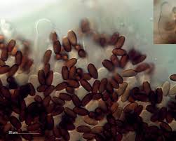 Attēlu rezultāti vaicājumam “Lycogala cf. oleocrystalliferum”