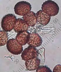 Attēlu rezultāti vaicājumam “Tranzschelia pruni-spinosae”