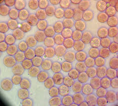Attēlu rezultāti vaicājumam “Lycogala ustulatum sessile”