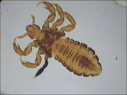 Attēlu rezultāti vaicājumam “Pediculus humanus capitis”