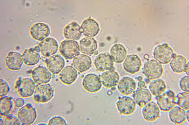 Attēlu rezultāti vaicājumam “Heterotrichia insignis (syn. Arcyria insignis) spores”