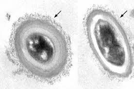 Attēlu rezultāti vaicājumam “Craterium aureum spores”