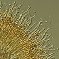 Attēlu rezultāti vaicājumam “Sclerophora pallida”