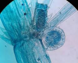 Attēlu rezultāti vaicājumam “Chara aspera male”