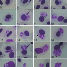 Attēlu rezultāti vaicājumam “undetermined plasmodium”