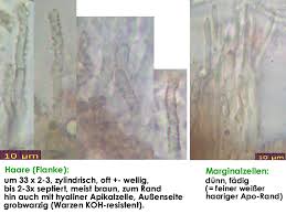 Attēlu rezultāti vaicājumam “Hyphodiscus hymeniophilus”