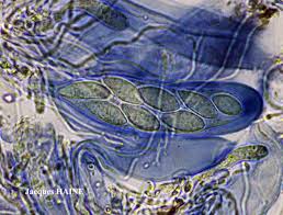 Attēlu rezultāti vaicājumam “Porpidia macrocarpa”