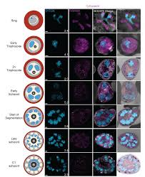 Attēlu rezultāti vaicājumam “Enteridium variabile plasmodium”