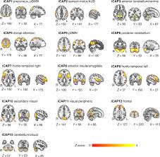 Image result for High Moor Motor Club