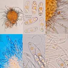 Attēlu rezultāti vaicājumam “Octosporella jungermanniarum”
