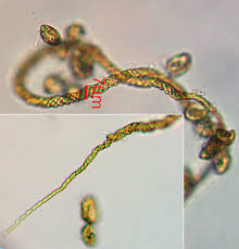 Attēlu rezultāti vaicājumam “Lycogala ustulatum sessile”