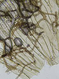 Attēlu rezultāti vaicājumam “Arcyria incarnata calyculus”