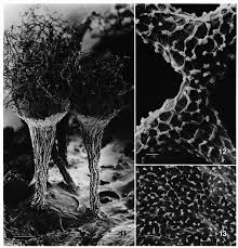 Attēlu rezultāti vaicājumam “Arcyria imperialis stalked”