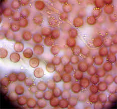 Attēlu rezultāti vaicājumam “Craterium aureonucleatum young”