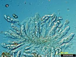 Attēlu rezultāti vaicājumam “Badhamiopsis praetermissa spores”