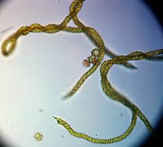 Attēlu rezultāti vaicājumam “Trichia longipalpis sessile”