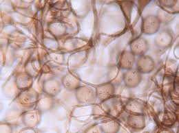 Attēlu rezultāti vaicājumam “Paradiacheopsis sp.”