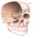 Sinus headache - sinusitis